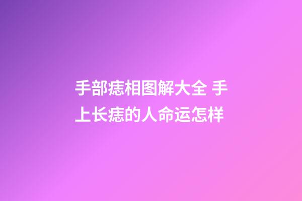 手部痣相图解大全 手上长痣的人命运怎样